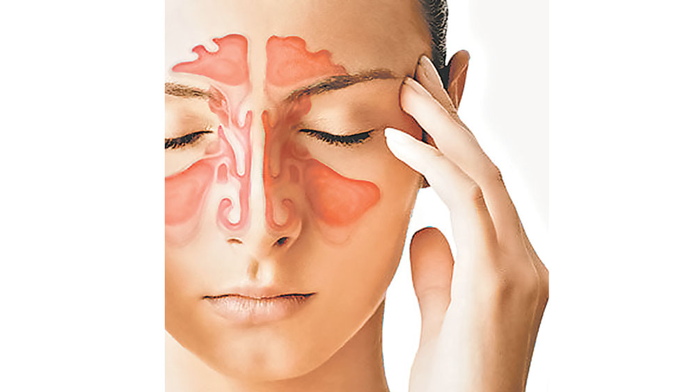 clarithromycin 500 mg used for sinus infection