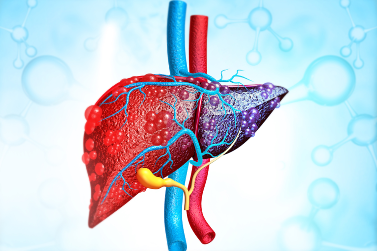 Ayurvedic Treatment for Liver Disorders in Bangalore – Heal Your Liver Naturally