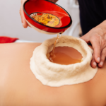 What Is Basti in Ayurveda? Benefits, Types & Who Needs It