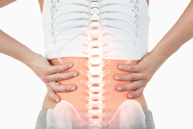 Natural Treatment for Lumbar Spondylosis in Bangalore: Ayurvedic Solutions for Lasting Back Pain Relief