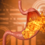 Acidity Treatment with Ayurveda: Natural Remedies, Diet & Wellness Tips