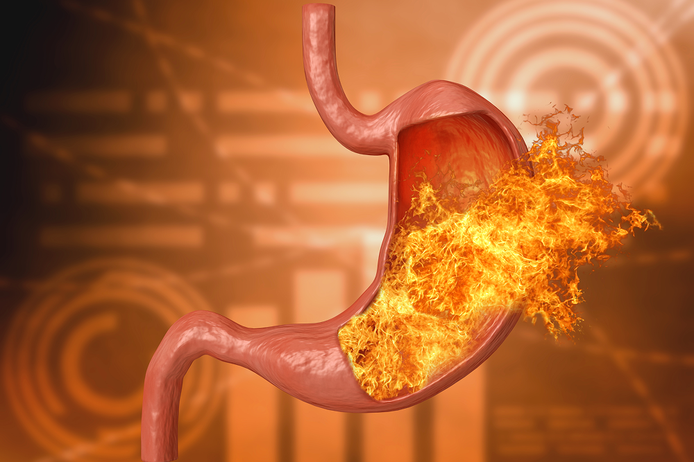 Acidity Treatment with Ayurveda: Natural Remedies, Diet & Wellness Tips