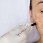 Ayurvedic Treatment for Skin Whitening: Herbs, Benefits & Skin Care Tips