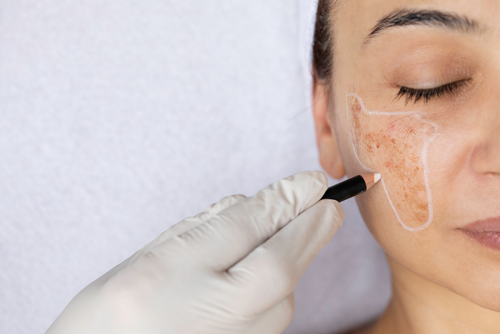 Ayurvedic Treatment for Skin Whitening: Herbs, Benefits & Skin Care Tips